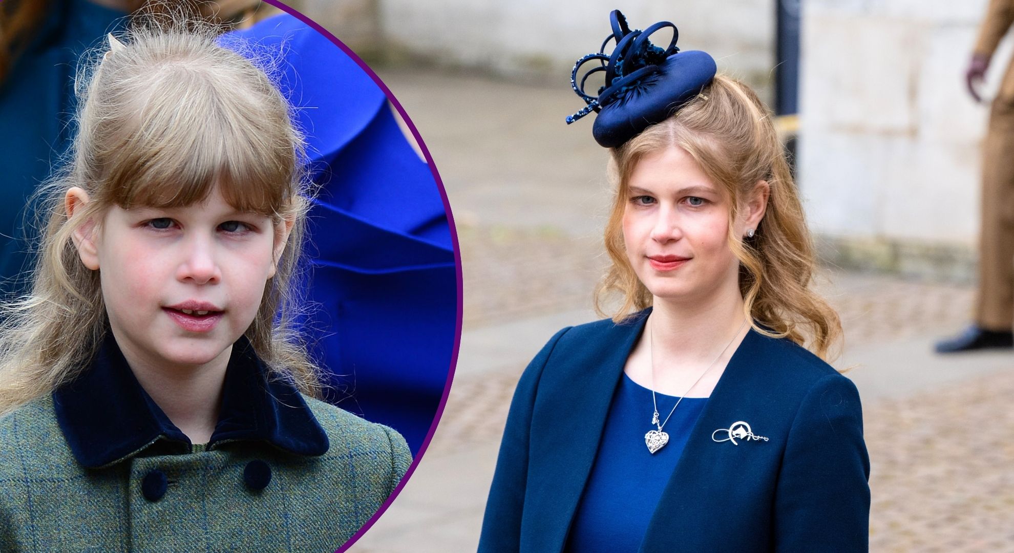 Lady Louise Windsor's rare condition that affects her eyes explained