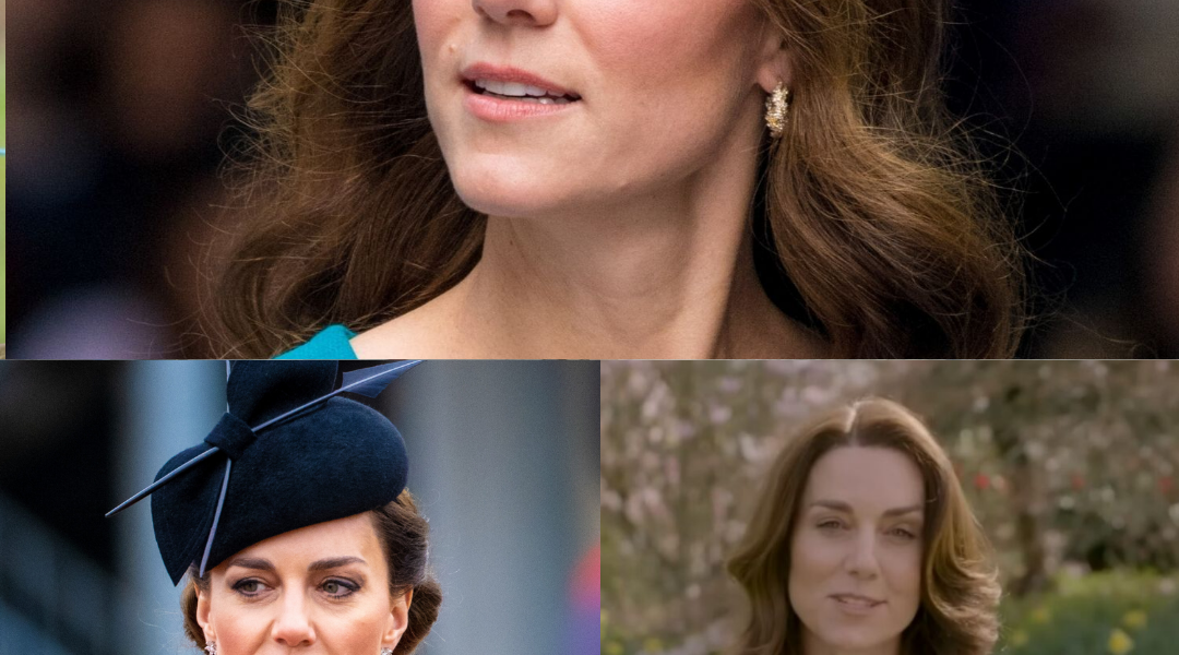 Kate Middleton’s apology as she underwent abdominal surgery