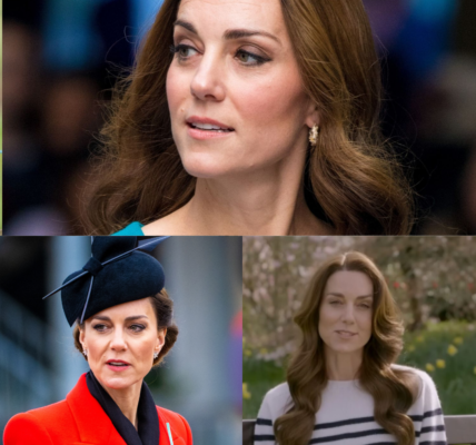 Kate Middleton’s apology as she underwent abdominal surgery