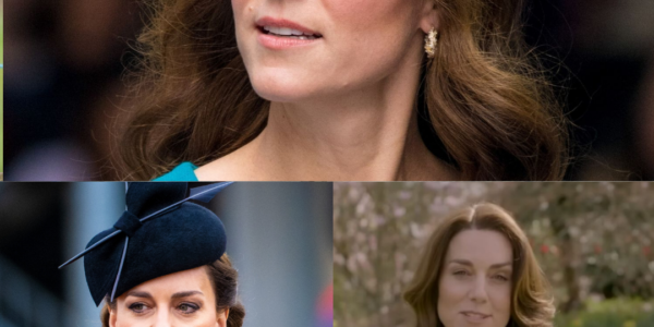 Kate Middleton’s apology as she underwent abdominal surgery