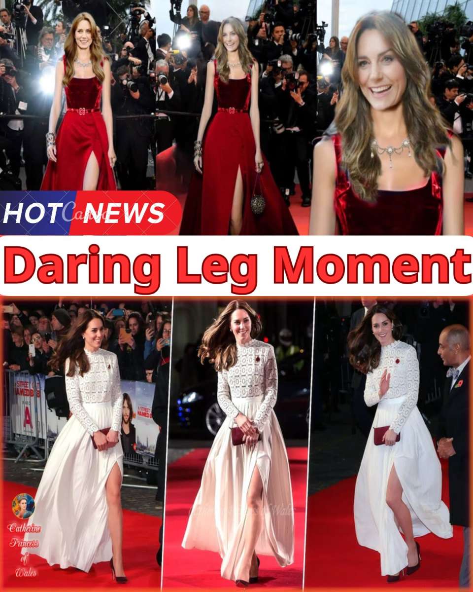 Catherine Dazzles with Bold Leg Reveals, Leaving Fans in Awe of Her Unforgettable Royal Style!