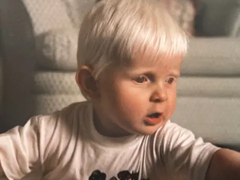 Albino hypnotist Fraser Penman: I hypnotised myself to become a ...